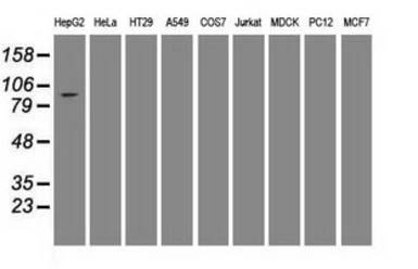 Anti-USP13 antibody [4G11] used in Western Blot (WB). GTX83436