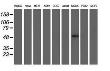 Anti-UHMK1 antibody [2H4] used in Western Blot (WB). GTX83438