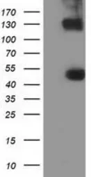 Anti-UHMK1 antibody [2H4] used in Western Blot (WB). GTX83438