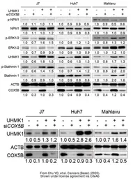 Anti-UHMK1 antibody [5E10] used in Western Blot (WB). GTX83440