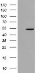 Anti-UHMK1 antibody [5E10] used in Western Blot (WB). GTX83440