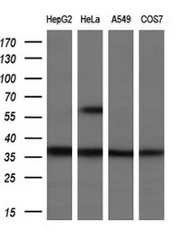 Anti-UCK1 antibody [5E9] used in Western Blot (WB). GTX83441
