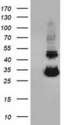Anti-UCK1 antibody [5E9] used in Western Blot (WB). GTX83441
