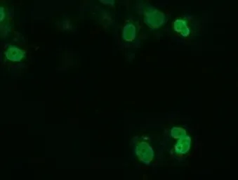 Anti-UCK1 antibody [5E9] used in Immunocytochemistry/ Immunofluorescence (ICC/IF). GTX83441