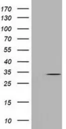 Anti-UCK1 antibody [1A12] used in Western Blot (WB). GTX83442