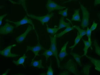 Anti-UCK1 antibody [1A12] used in Immunocytochemistry/ Immunofluorescence (ICC/IF). GTX83442