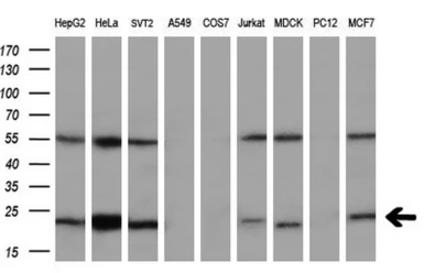 Anti-UBE2T antibody [2F5] used in Western Blot (WB). GTX83452