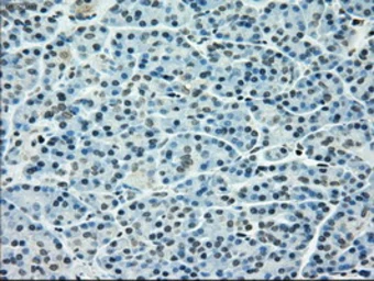 Anti-TYRO3 antibody [9B12] used in IHC (Paraffin sections) (IHC-P). GTX83453