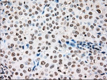 Anti-TYRO3 antibody [2C4] used in IHC (Paraffin sections) (IHC-P). GTX83458