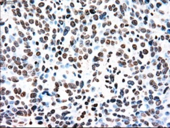Anti-TYRO3 antibody [2C4] used in IHC (Paraffin sections) (IHC-P). GTX83458