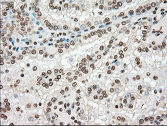 Anti-TYRO3 antibody [2C4] used in IHC (Paraffin sections) (IHC-P). GTX83458