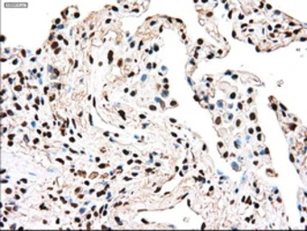 Anti-TYRO3 antibody [2C4] used in IHC (Paraffin sections) (IHC-P). GTX83458