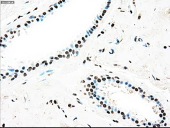 Anti-TYRO3 antibody [2C4] used in IHC (Paraffin sections) (IHC-P). GTX83458