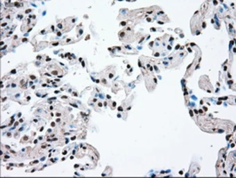 Anti-TYRO3 antibody [2C4] used in IHC (Paraffin sections) (IHC-P). GTX83458