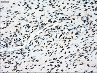 Anti-TYRO3 antibody [2C4] used in IHC (Paraffin sections) (IHC-P). GTX83458