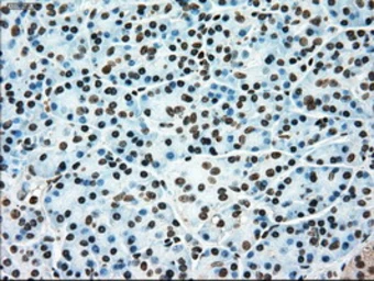 Anti-TYRO3 antibody [2C4] used in IHC (Paraffin sections) (IHC-P). GTX83458