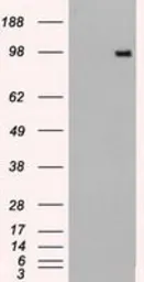 Anti-TYRO3 antibody [2C4] used in Western Blot (WB). GTX83458