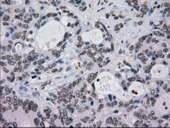 Anti-TYRO3 antibody [5B4] used in IHC (Paraffin sections) (IHC-P). GTX83459