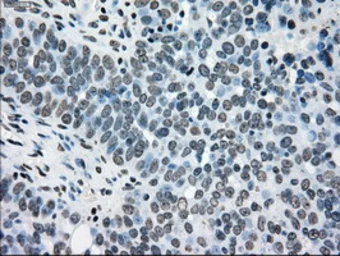Anti-TYRO3 antibody [5B4] used in IHC (Paraffin sections) (IHC-P). GTX83459