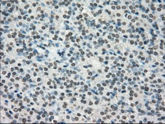 Anti-TYRO3 antibody [5B4] used in IHC (Paraffin sections) (IHC-P). GTX83459