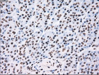 Anti-TYRO3 antibody [5B4] used in IHC (Paraffin sections) (IHC-P). GTX83459
