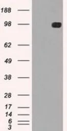 Anti-TYRO3 antibody [5B4] used in Western Blot (WB). GTX83459