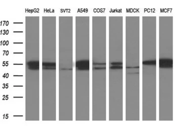 Anti-beta Tubulin 3/ Tuj1 antibody [5H2] used in Western Blot (WB). GTX83460