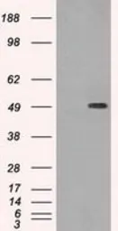 Anti-beta Tubulin 3/ Tuj1 antibody [5H2] used in Western Blot (WB). GTX83460