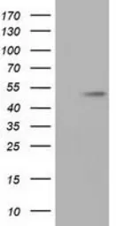 Anti-alpha Tubulin 8 antibody [2C2] used in Western Blot (WB). GTX83461