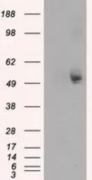 Anti-alpha Tubulin 8 antibody [3E10] used in Western Blot (WB). GTX83463
