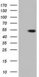 Anti-TUBA3E antibody [2A8] used in Western Blot (WB). GTX83467
