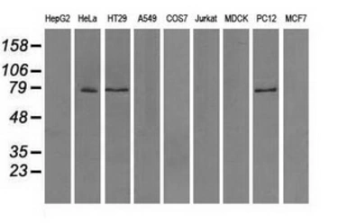 Anti-TTLL12 antibody [4B2] used in Western Blot (WB). GTX83473