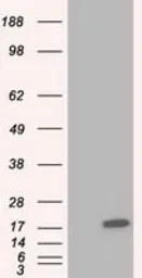Anti-TTC32 antibody [5C12] used in Western Blot (WB). GTX83482