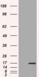 Anti-TTC32 antibody [1F7] used in Western Blot (WB). GTX83486