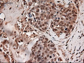 Anti-TIF1 gamma antibody [9D4] used in IHC (Paraffin sections) (IHC-P). GTX83492