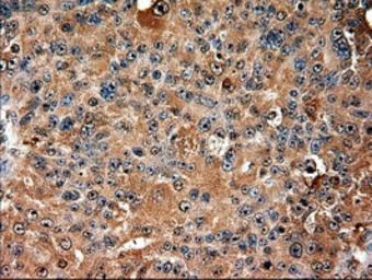 Anti-TIF1 gamma antibody [9D4] used in IHC (Paraffin sections) (IHC-P). GTX83492