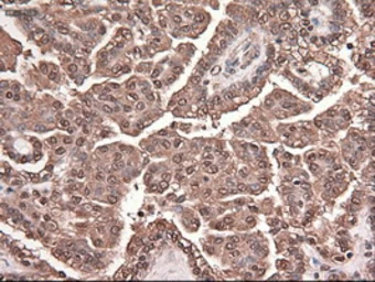 Anti-TIF1 gamma antibody [9D4] used in IHC (Paraffin sections) (IHC-P). GTX83492