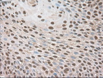 Anti-TIF1 gamma antibody [9D4] used in IHC (Paraffin sections) (IHC-P). GTX83492