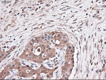 Anti-TIF1 gamma antibody [9D4] used in IHC (Paraffin sections) (IHC-P). GTX83492