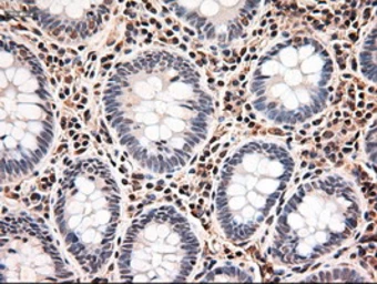 Anti-TIF1 gamma antibody [9D4] used in IHC (Paraffin sections) (IHC-P). GTX83492