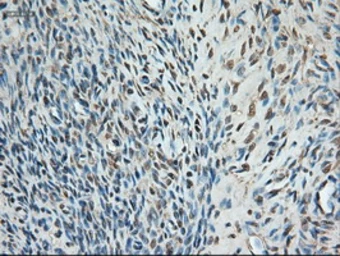Anti-TIF1 gamma antibody [9D4] used in IHC (Paraffin sections) (IHC-P). GTX83492