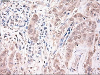 Anti-TIF1 gamma antibody [6B7] used in IHC (Paraffin sections) (IHC-P). GTX83493