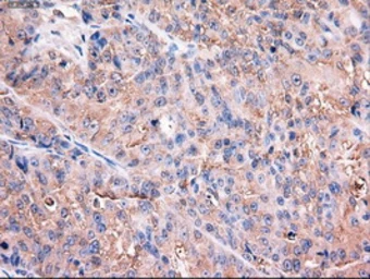 Anti-TIF1 gamma antibody [6B7] used in IHC (Paraffin sections) (IHC-P). GTX83493