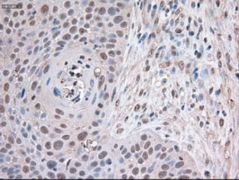Anti-TIF1 gamma antibody [6B7] used in IHC (Paraffin sections) (IHC-P). GTX83493
