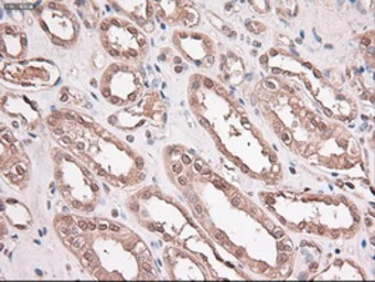 Anti-TIF1 gamma antibody [6B7] used in IHC (Paraffin sections) (IHC-P). GTX83493