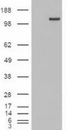 Anti-TIF1 gamma antibody [6B7] used in Western Blot (WB). GTX83493