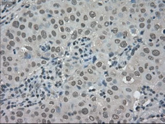 Anti-TRIB2 antibody [8D11] used in IHC (Paraffin sections) (IHC-P). GTX83495