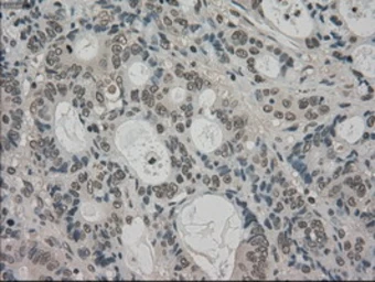 Anti-TRIB2 antibody [8D11] used in IHC (Paraffin sections) (IHC-P). GTX83495