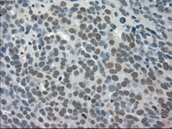 Anti-TRIB2 antibody [8D11] used in IHC (Paraffin sections) (IHC-P). GTX83495
