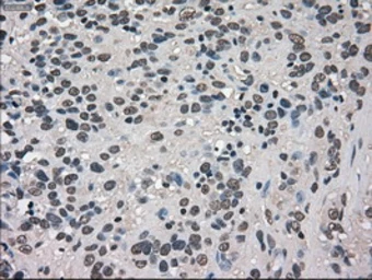 Anti-TRIB2 antibody [8D11] used in IHC (Paraffin sections) (IHC-P). GTX83495
